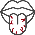 口の中が乾燥する